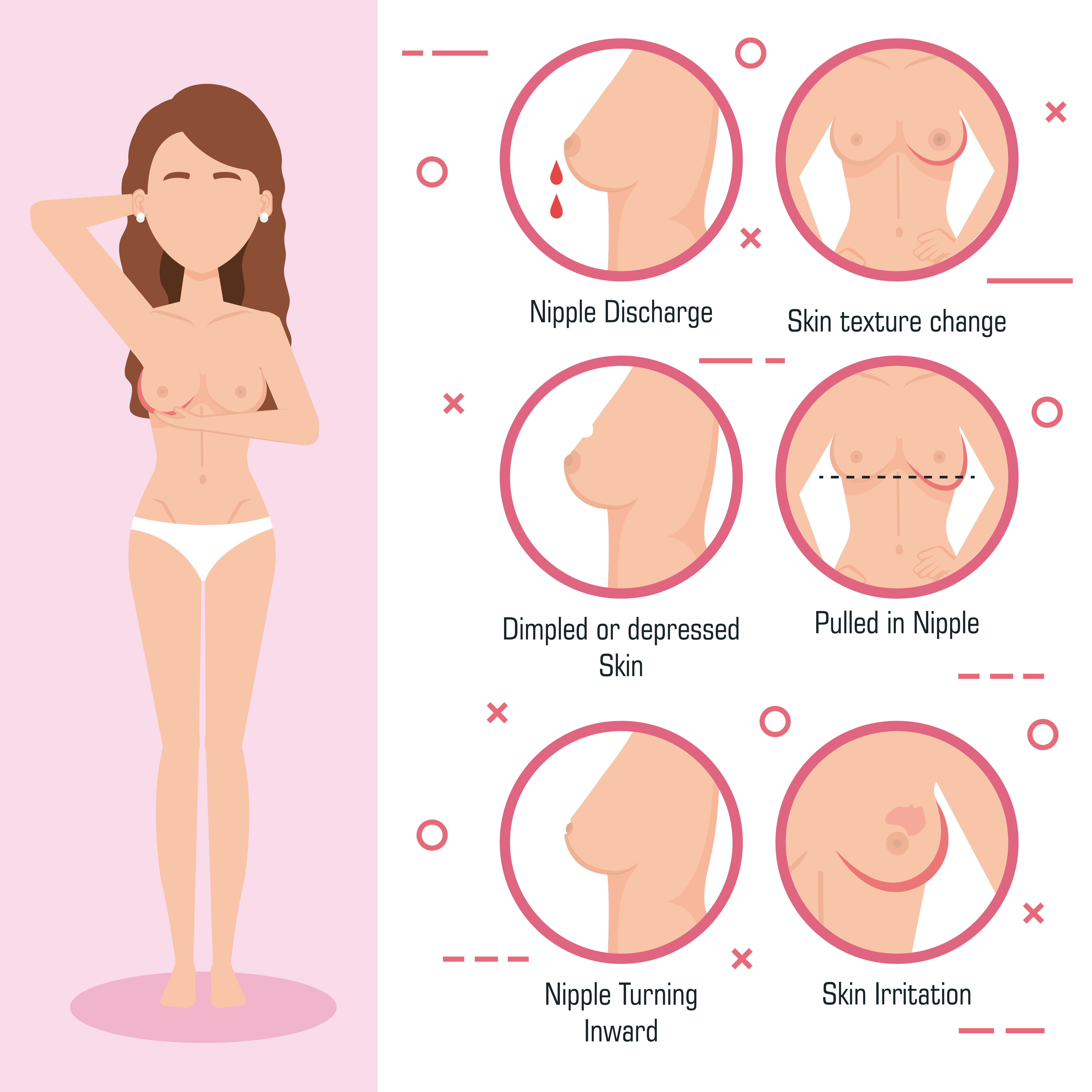 What are the signs and symptoms of breast cancer?